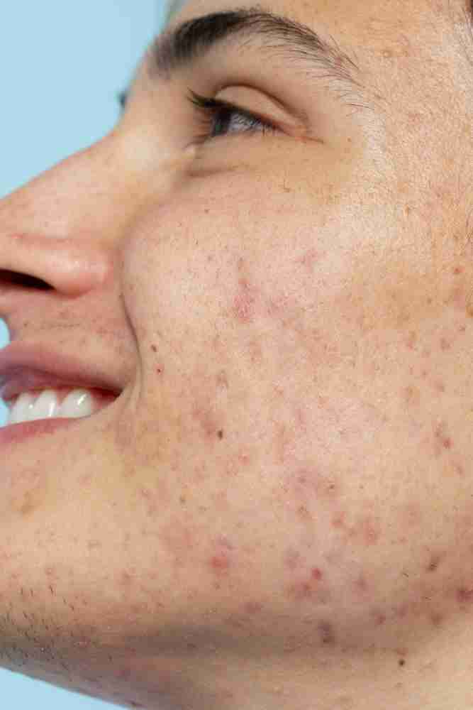 2149441225 Understanding Petechiae: Causes, Red Flags, and Advanced Treatment Options